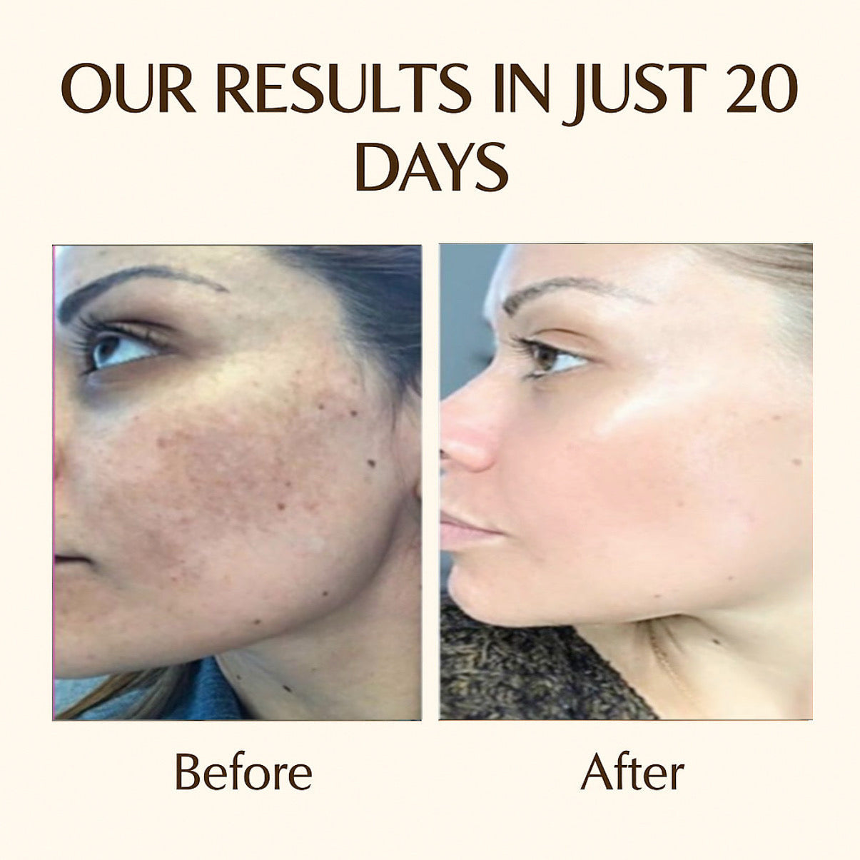 🌞 Day + Night Cream Combo – For best Results Glow & Protection!(100gm)