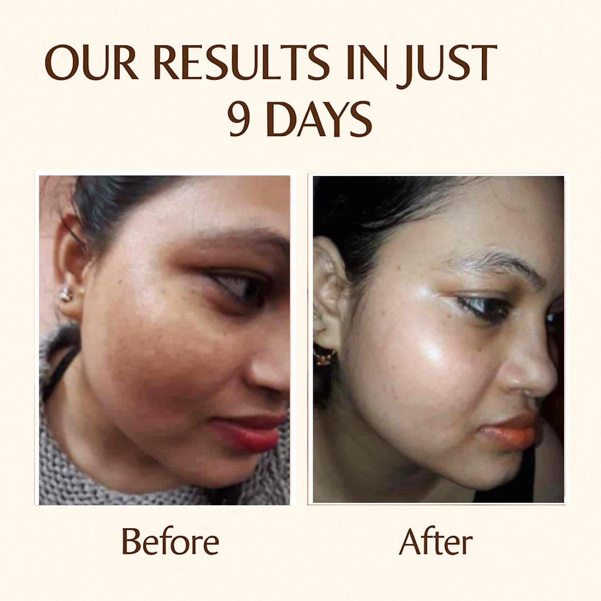 🌞 Day + Night Cream Combo – Fore best Results Glow & Protection!