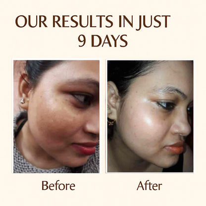 🌞🌙 Glow & Shine Ultimate Glow Combo – Face Wash + Day & Night Cream ✨🧴