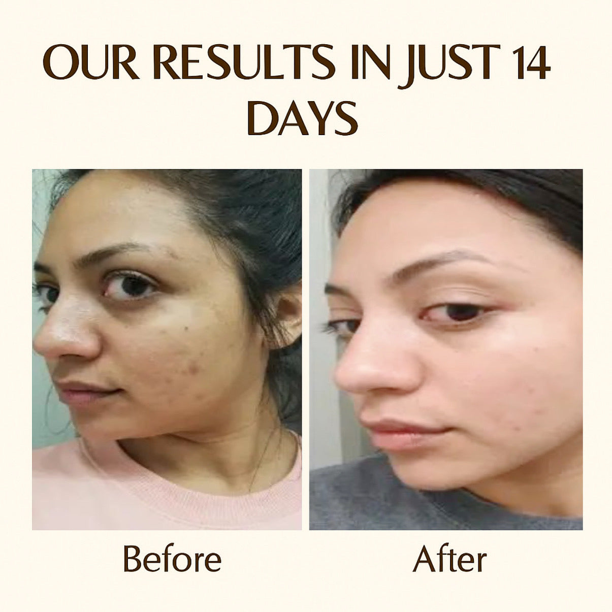 🌞 Day + Night Cream Combo – Fore best Results Glow & Protection!