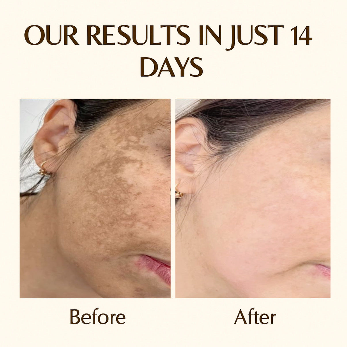 🌞 Day + Night Cream Combo – Fore best Results Glow & Protection!