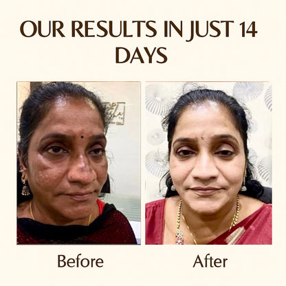 FACE AND BODY BRIGHTENING ALL PRODUCT COMBO