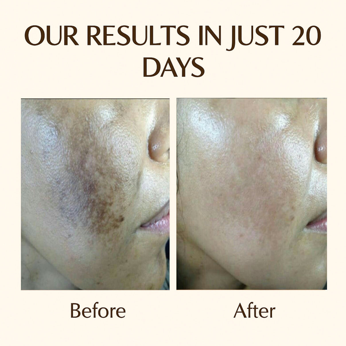 🌞 Day + Night Cream Combo – Fore best Results Glow & Protection!