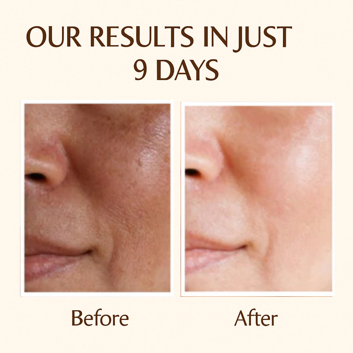 🌞 Day + Night Cream Combo – Fore best Results Glow & Protection!